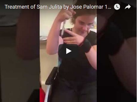 Treatment of Sam Julita by Jose Palomar